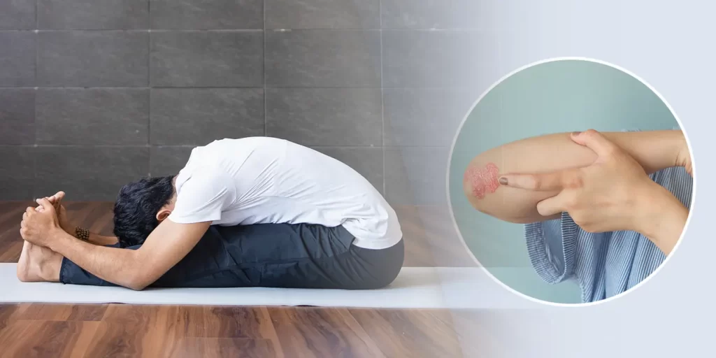 See How Practicing Hot Yoga May Help Your Chronic Arthritis… | Tristate  Arthritis & Rheumatology