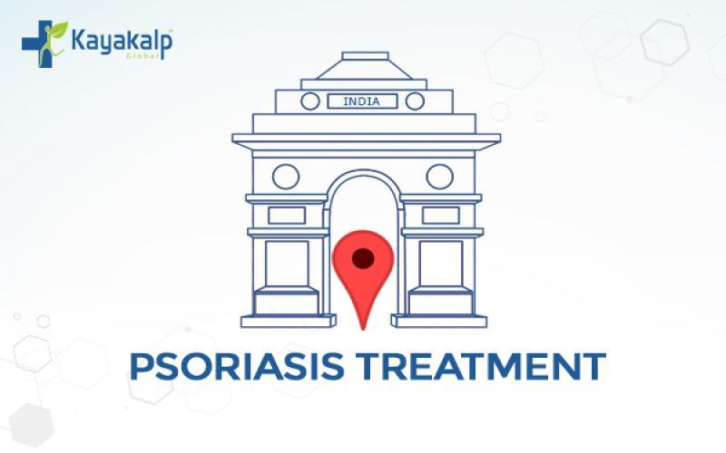 Psoriasis Treatment in Delhi NCR | Skin & Head Psoriasis Treatments